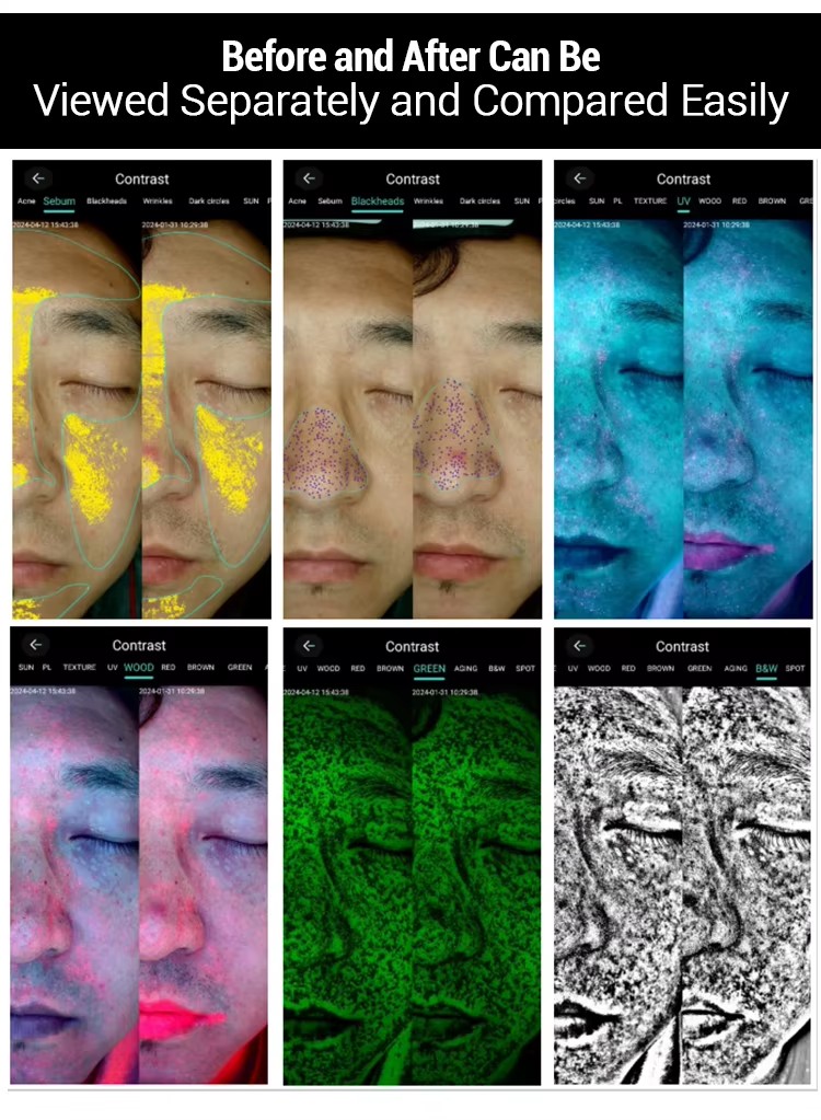 Skin Analysis Face diagnostics Machine-4.jpg